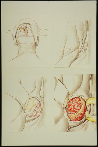 Picture: Medizinische Illustration