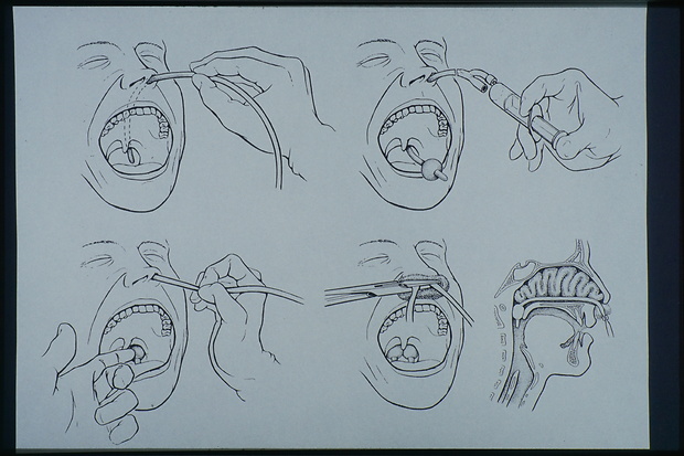 Picture: Medizinische Illustration: Kiefer-Chirurgie