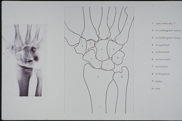 Bild:  Interpretation einer Röntgenaufnahme