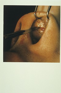 Bild:  Gesichts- Nasenchirurgie