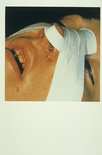 Bild:  Gesichts- Nasenchirurgie