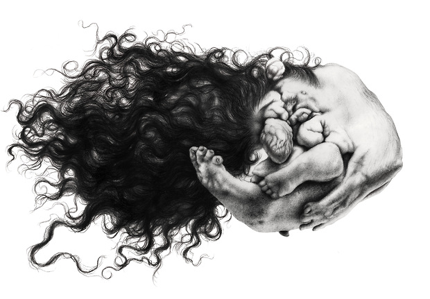 Bild:  Foetus-In-Foetu